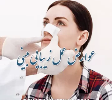 عوارض عمل بینی و پیشگیری از عوارض عمل بینی