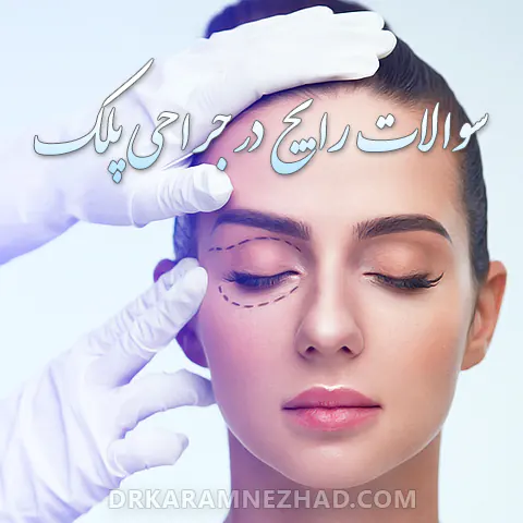 سوالات متداول درباره جراحی افتادگی پلک