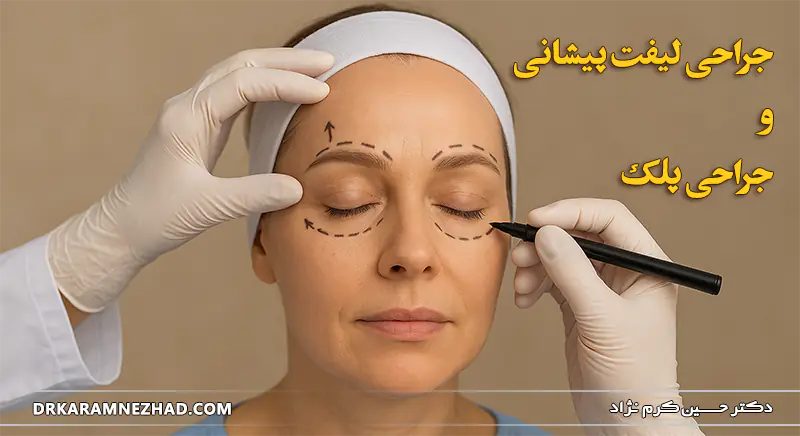 جراحی پلک و جراحی لیفت پیشانی